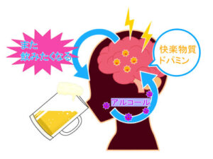 アルコール依存症